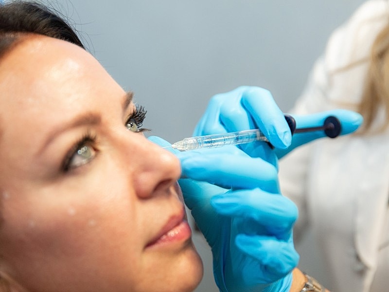 Why More Patients Are Dissolving Fillers in 2026 (And What They’re Choosing Instead)