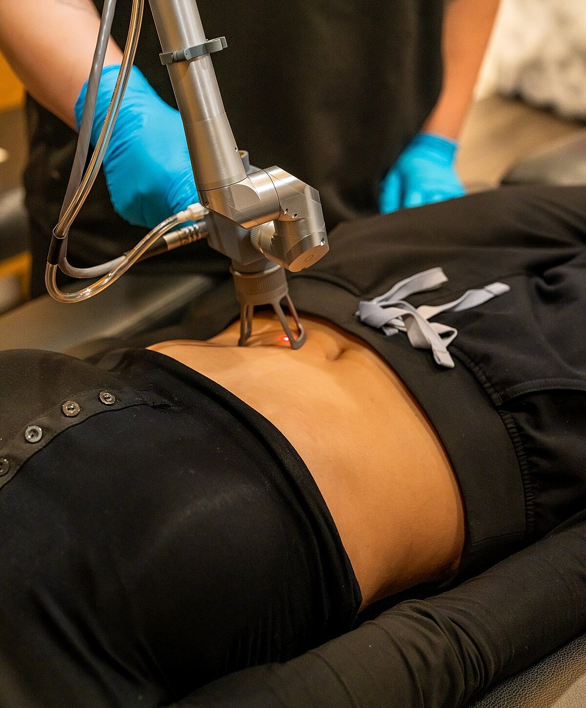 Laser treatment on a patient's abdomen area.