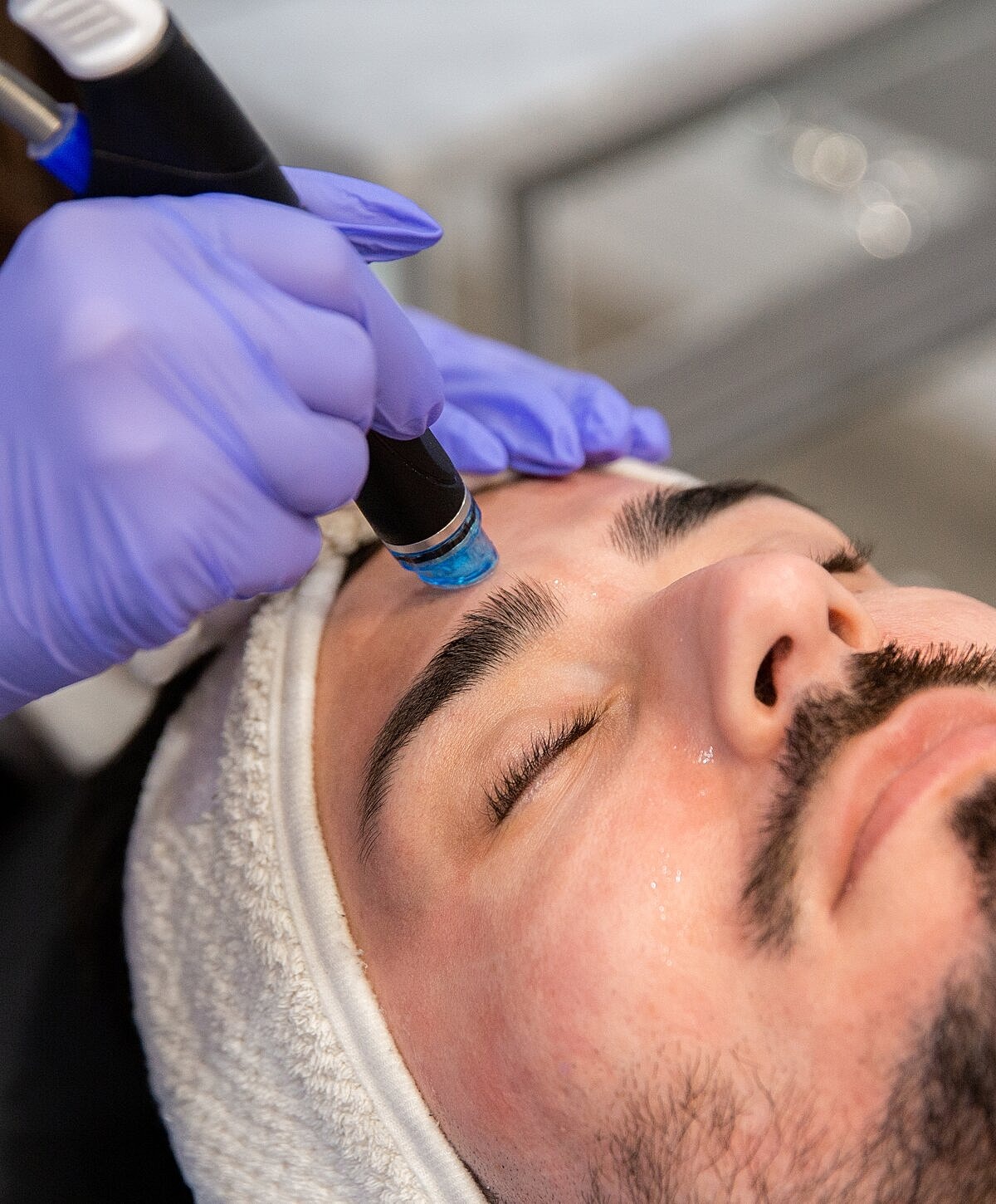 Microdermabrasion treatment on a client's forehead.