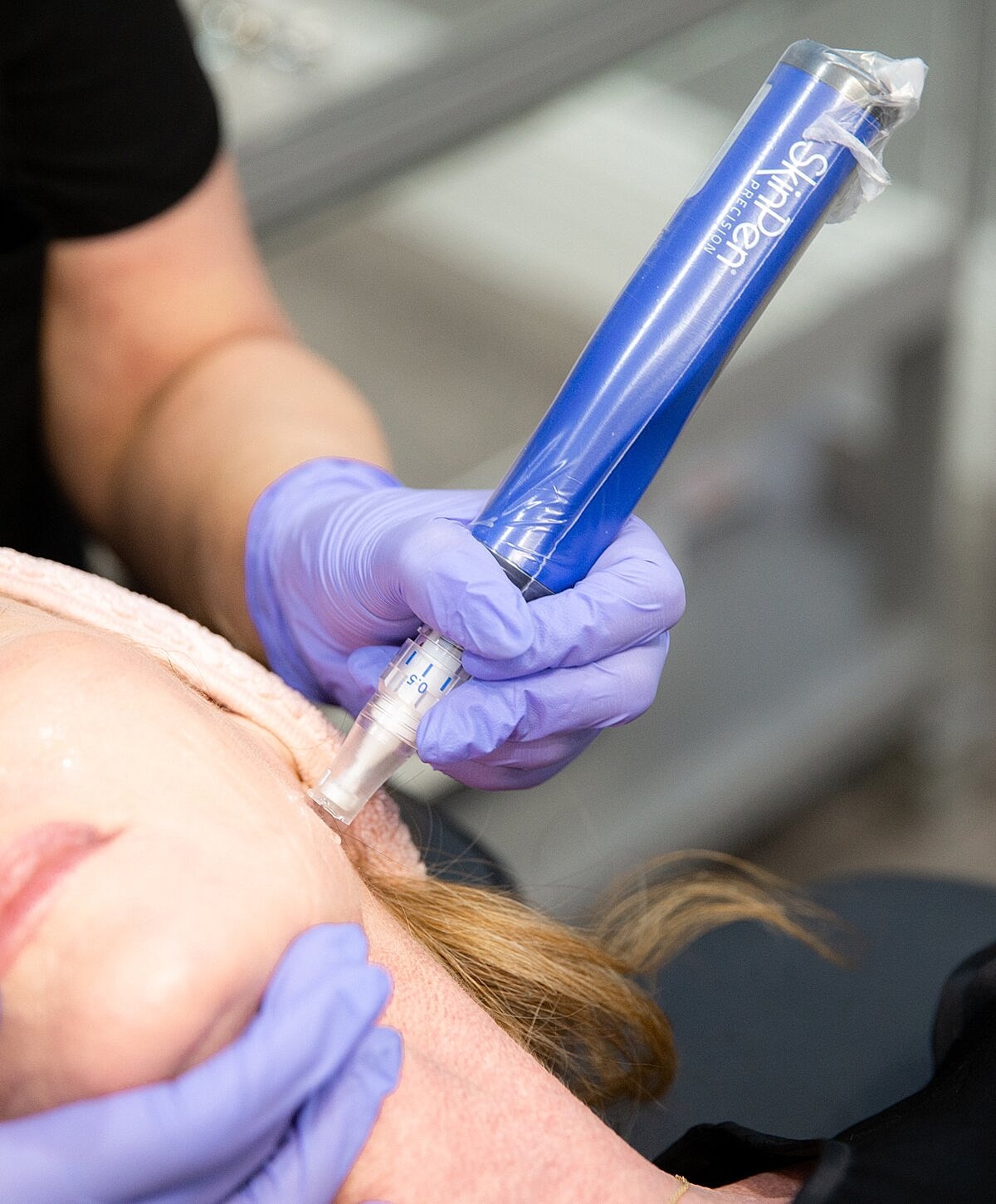 Microneedling procedure on a client's face.