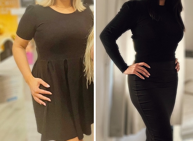 Medical Weight Loss Before & After