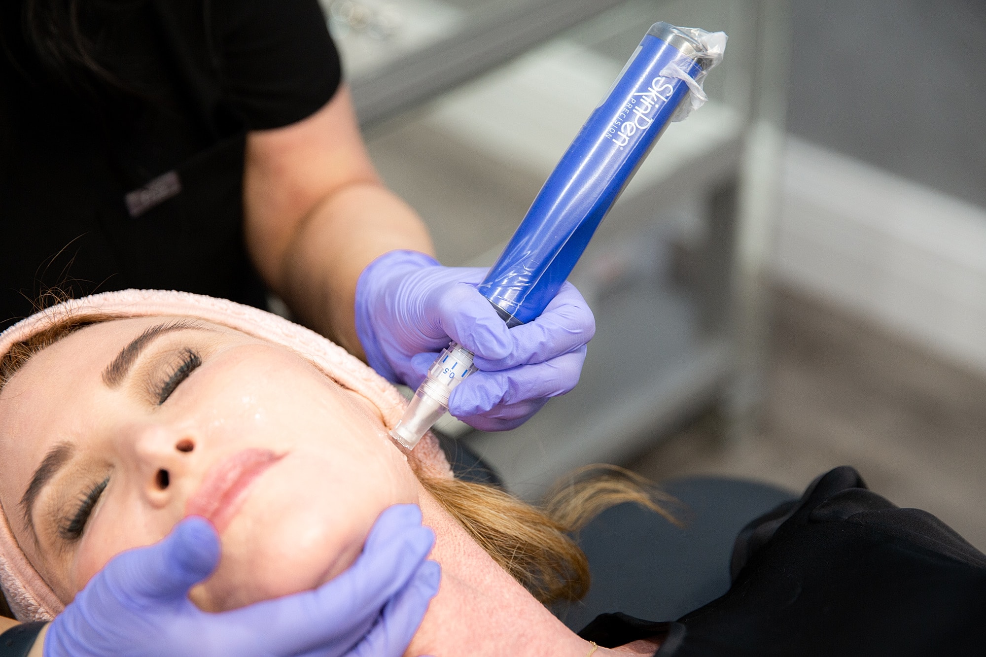 Microneedling treatment in a skincare session.